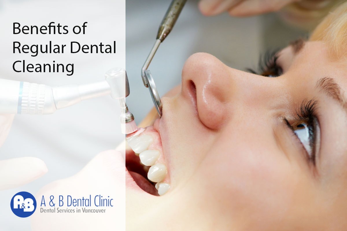 Benefits of Regular Dental Cleaning