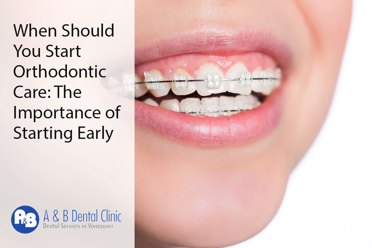 When Should You Start Orthodontic Care: The Importance of Starting Early