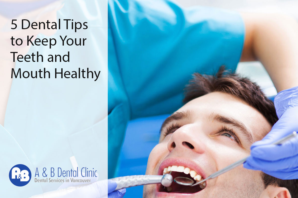 5 Dental Tips to Keep Your Teeth and Mouth Healthy