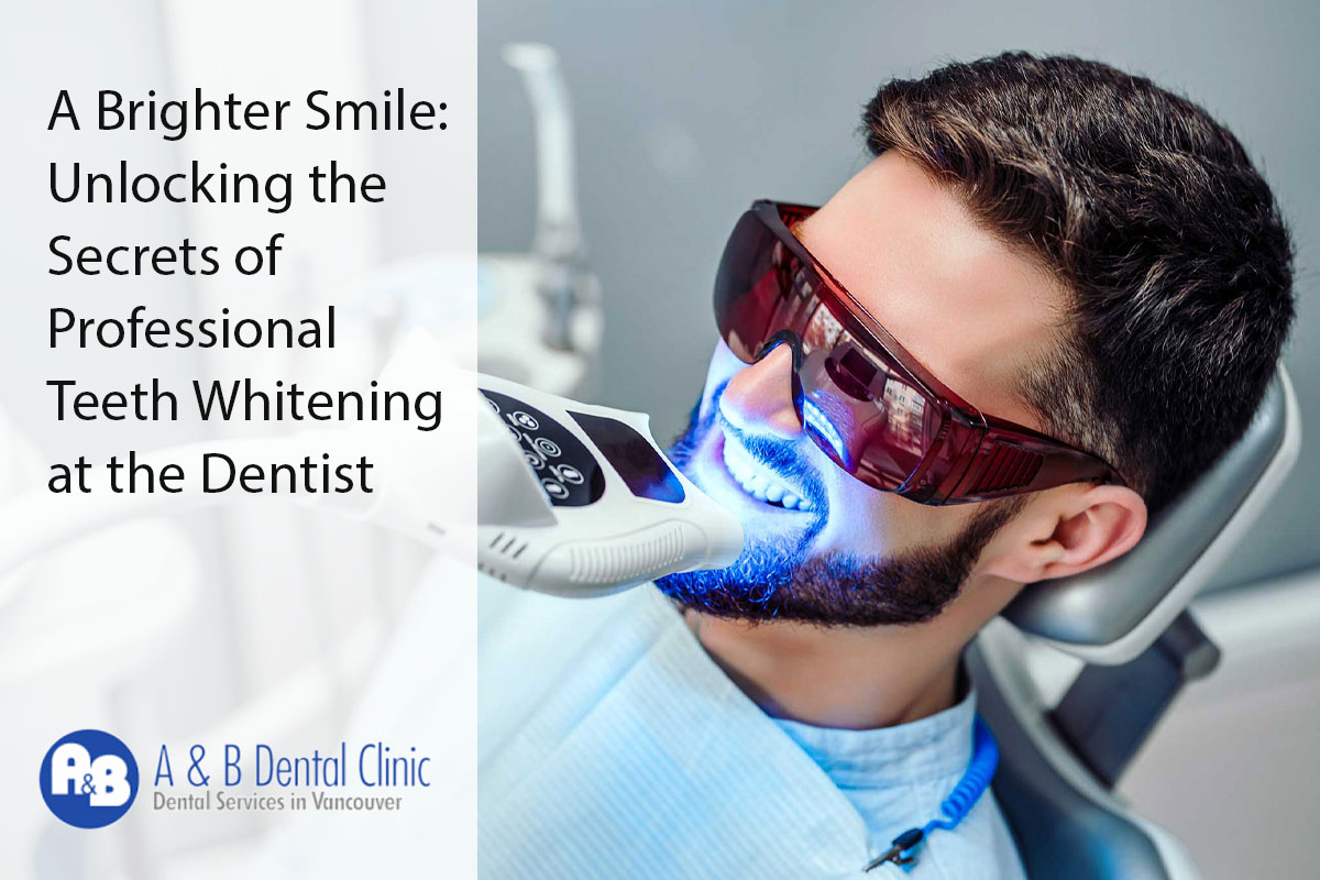 A Brighter Smile: Unlocking the Secrets of Professional Teeth Whitening at the Dentist