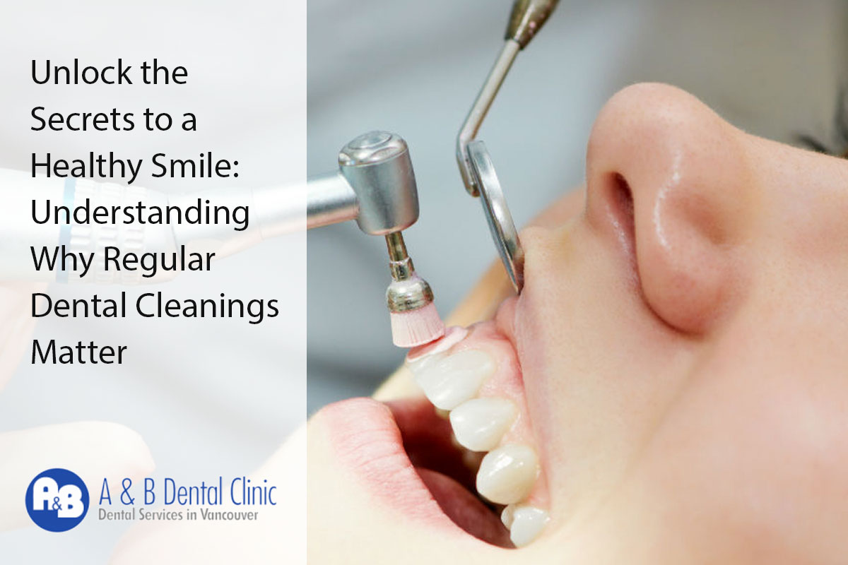 Unlock the Secrets to a Healthy Smile: Understanding Why Regular Dental Cleanings Matter