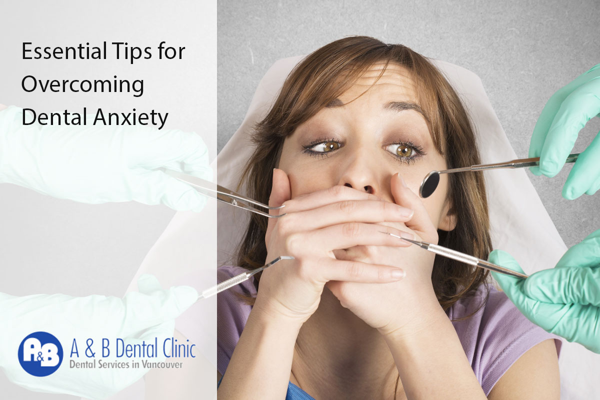 Essential Tips for Overcoming Dental Anxiety