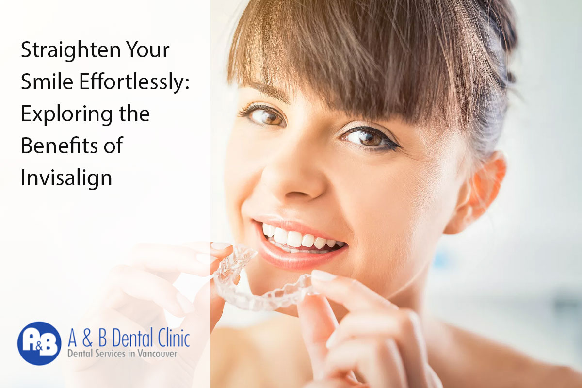 Straighten Your Smile Effortlessly: Exploring the Benefits of Invisalign