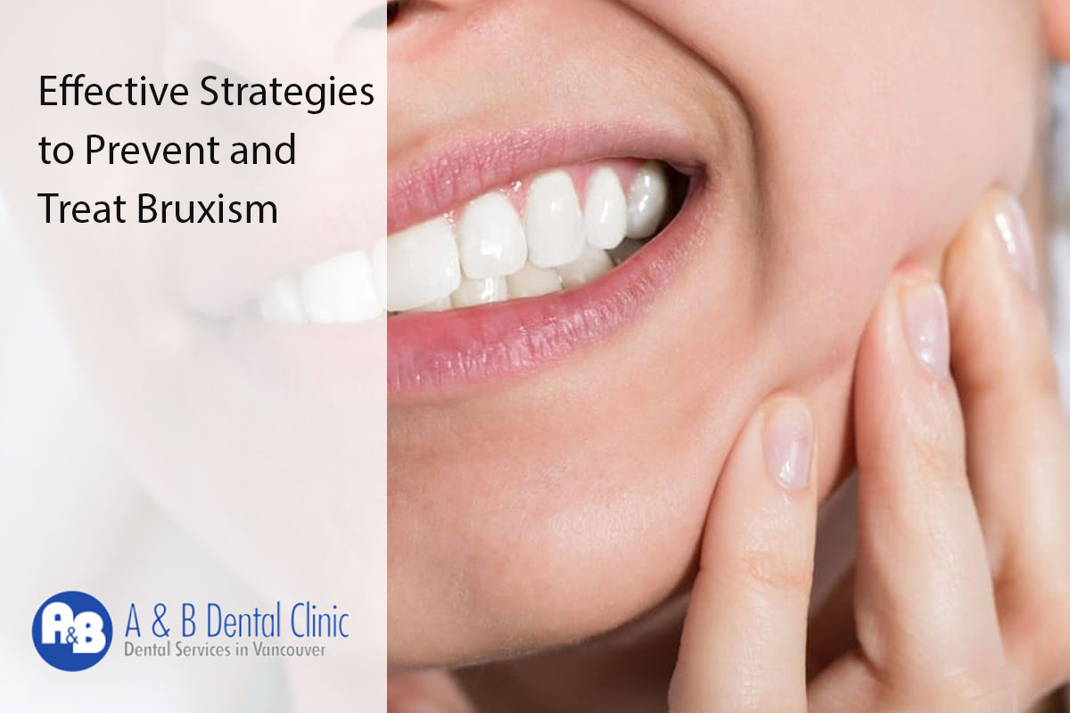 Effective Strategies to Prevent and Treat Bruxism