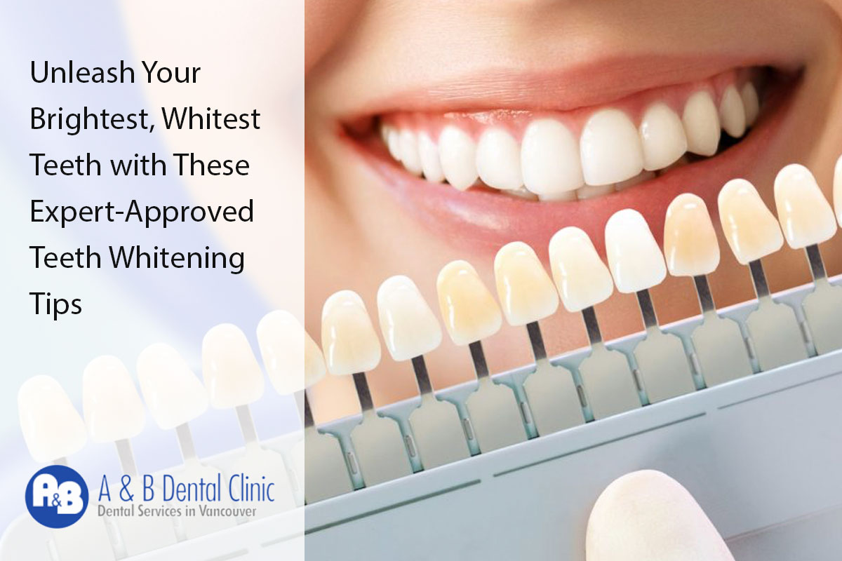 Unleash Your Brightest, Whitest Teeth with These Expert-Approved Teeth Whitening Tips