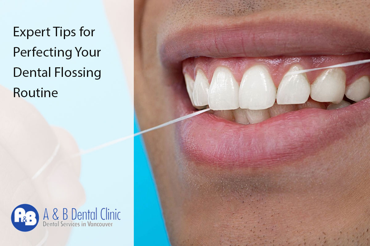 Expert Tips for Perfecting Your Dental Flossing Routine