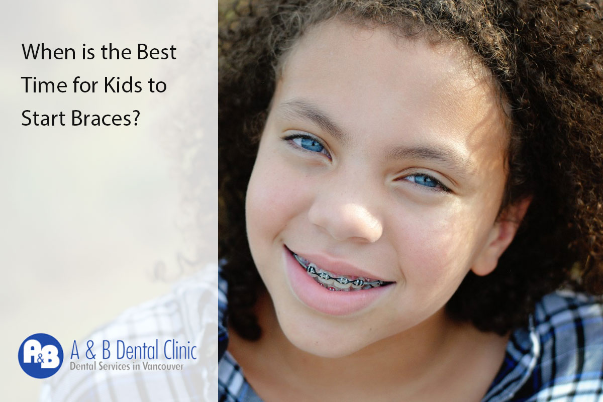 When is the Best Time for Kids to Start Braces?