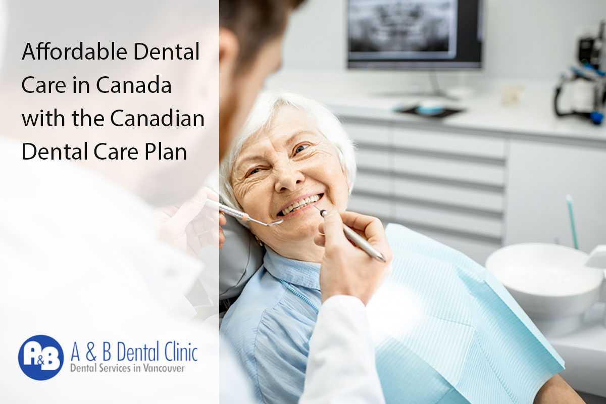 Affordable Dental Care in Canada with the Canadian Dental Care Plan