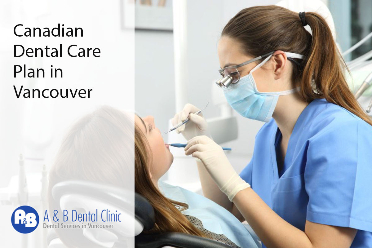 Canadian Dental Care Plan in Vancouver
