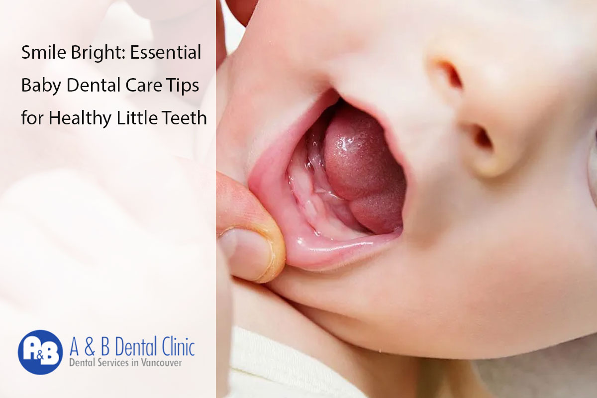 Smile Bright: Essential Baby Dental Care Tips for Healthy Little Teeth