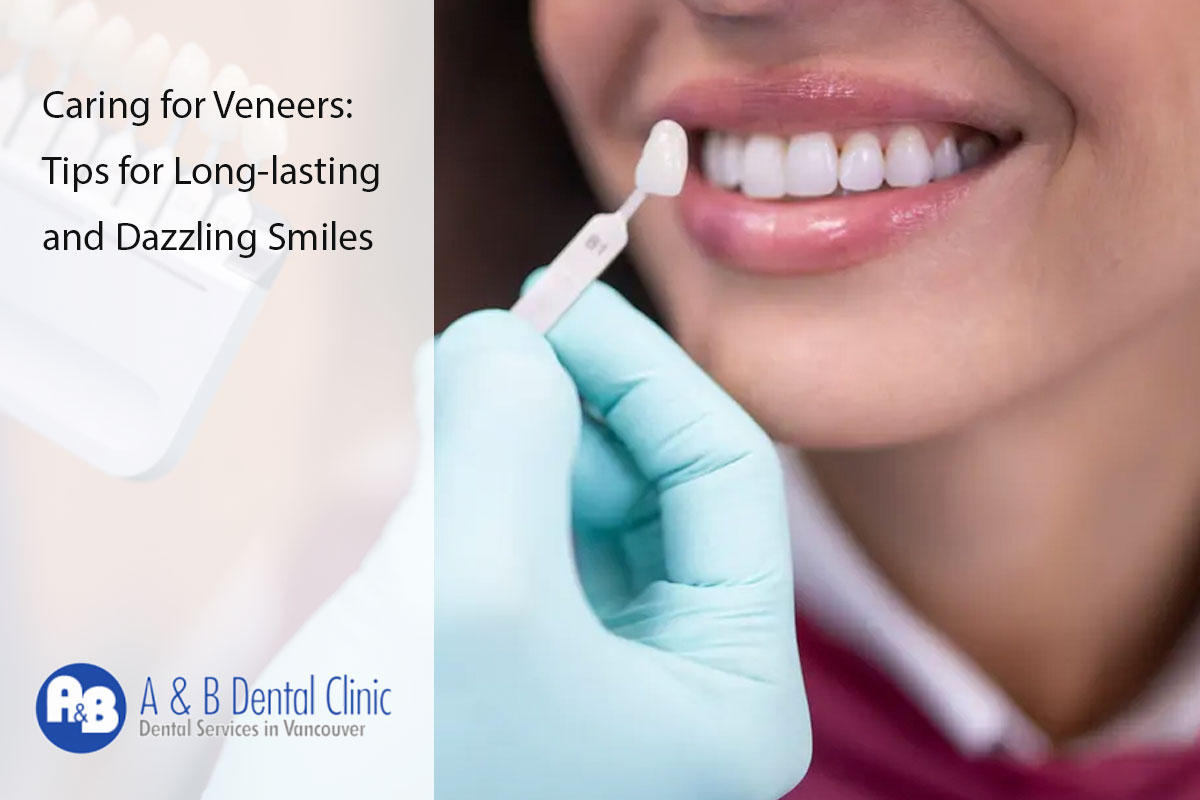 Caring for Veneers: Tips for Long-lasting and Dazzling Smiles