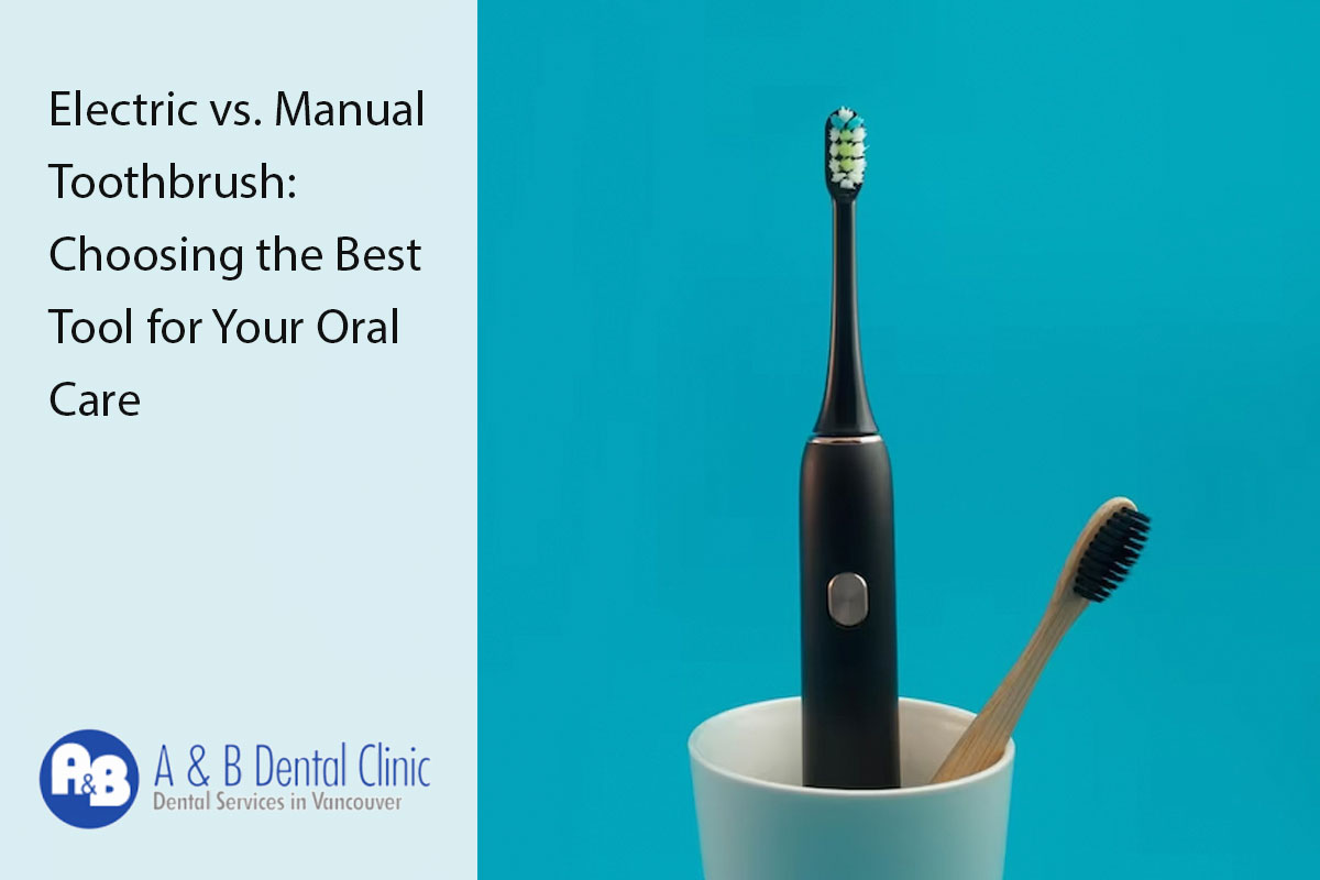 Electric vs. Manual Toothbrush: Choosing the Best Tool for Your Oral Care