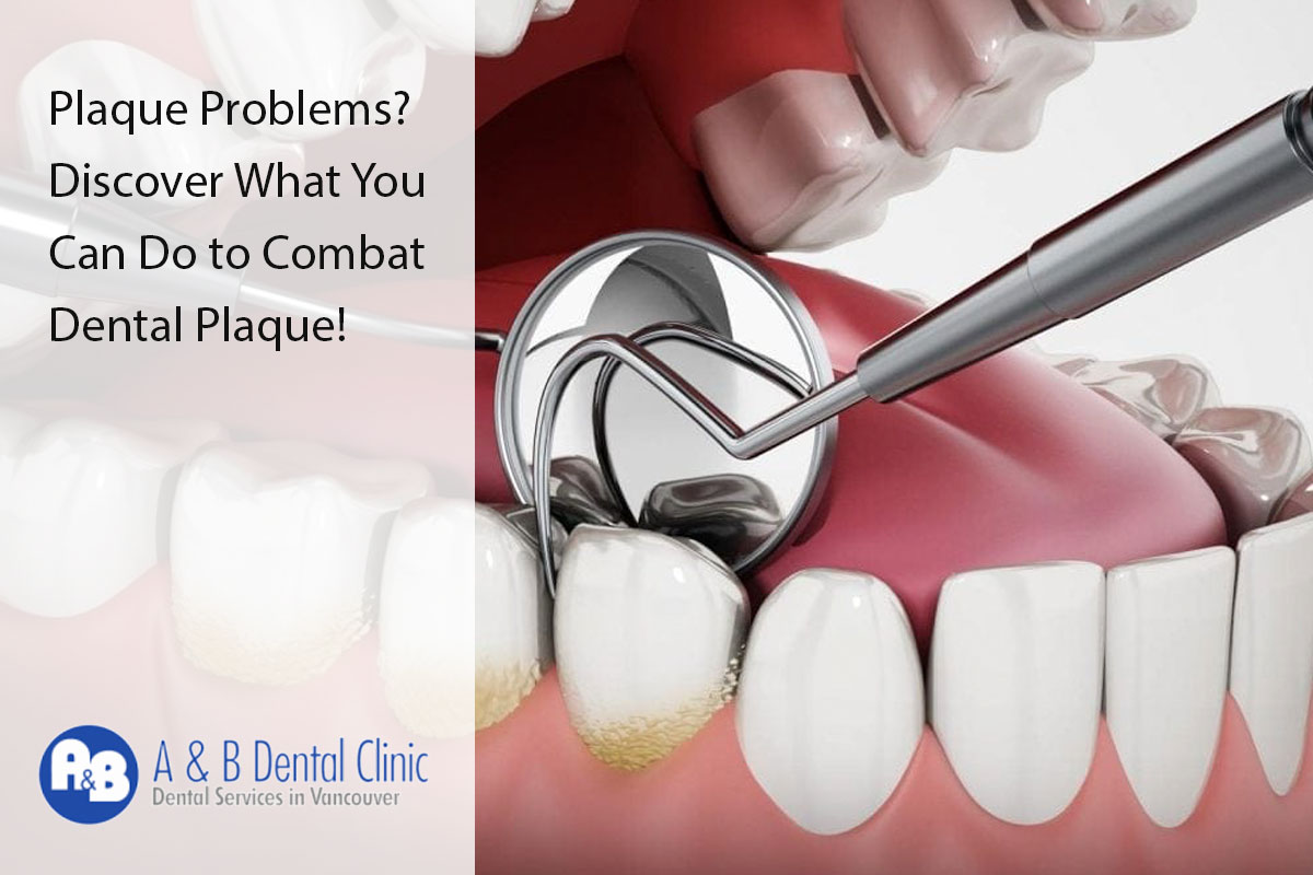 Plaque Problems? Discover What You Can Do to Combat Dental Plaque!