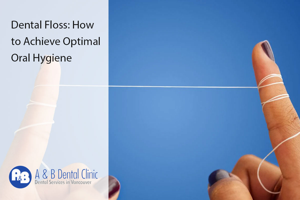 Dental Floss: How to Achieve Optimal Oral Hygiene