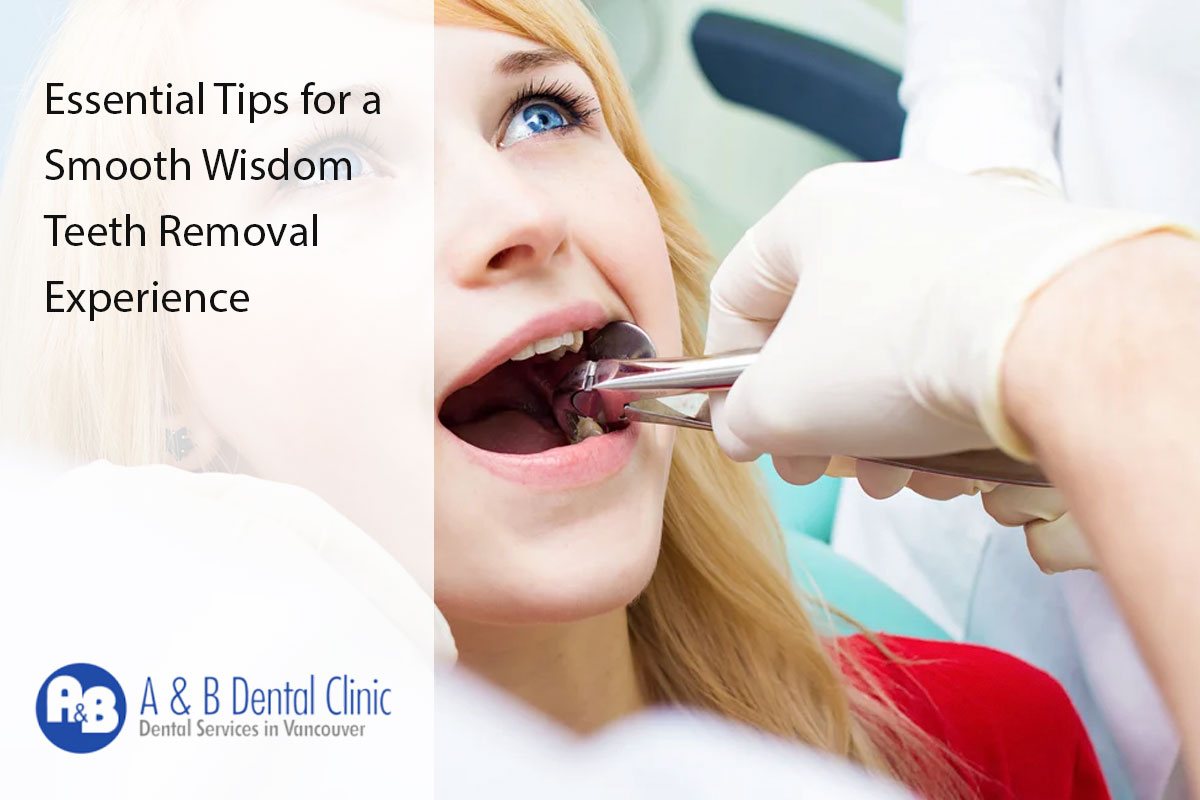 Essential Tips for a Smooth Wisdom Teeth Removal Experience